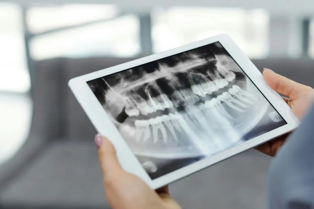 Pet xray image Pet dental Xray